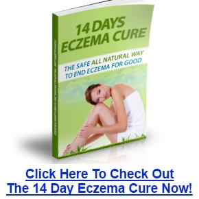 14 Days Eczema Cure Review