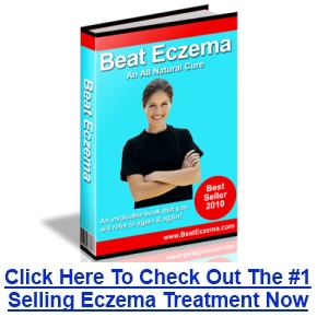 Beat Eczema Review